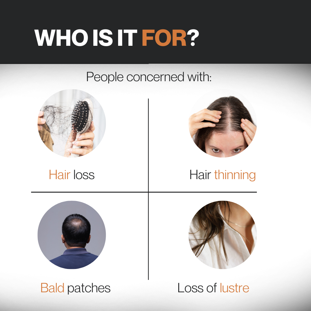 Hair Growth Serum – Biotin & Redensyl, 30ML