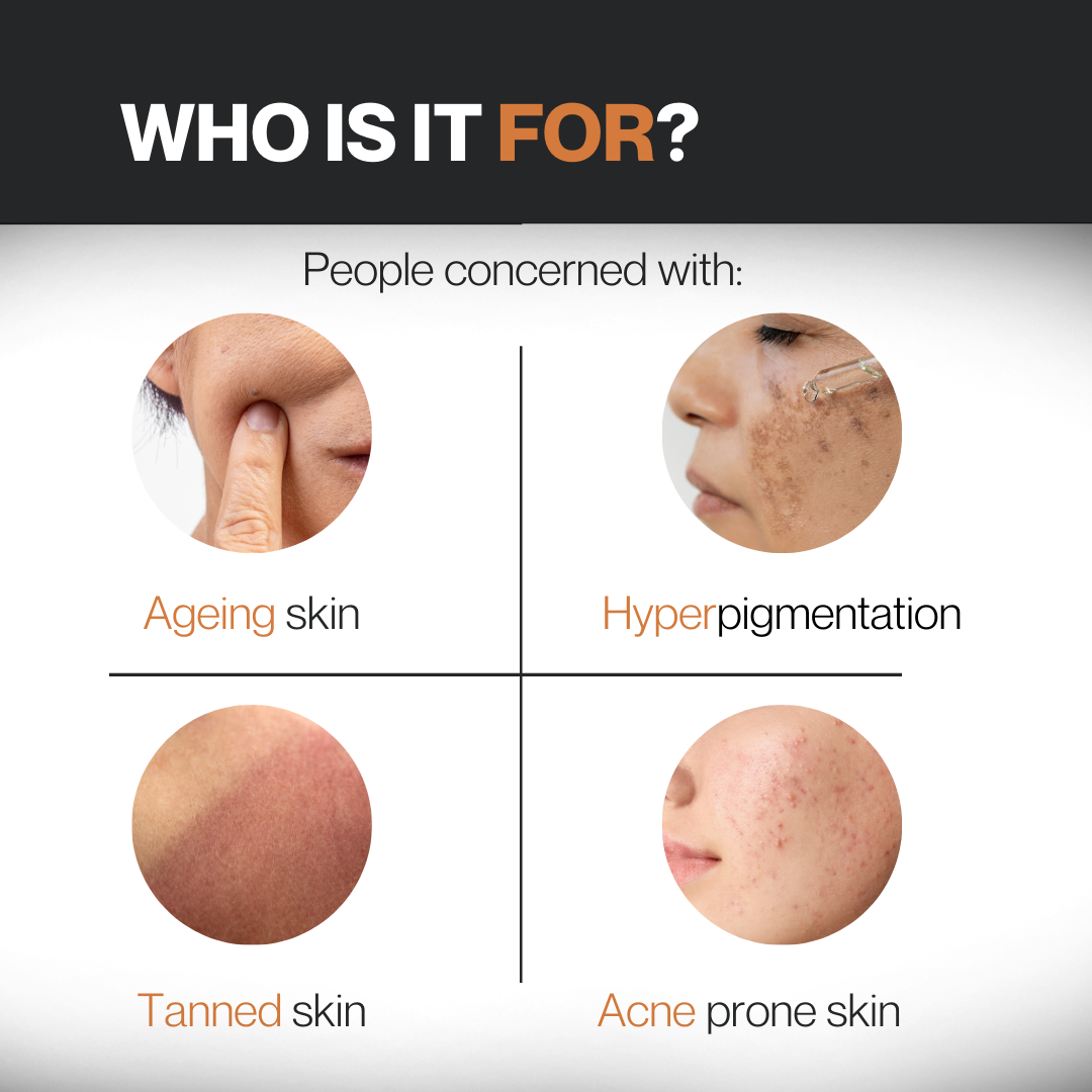 10% Vitamin C Face Serum || Brightens Skin | Evens Tone | Fades Dark Spots